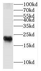 FXYD7 Antibody - BSA Free