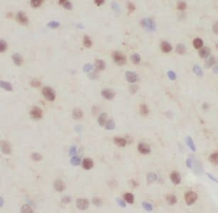 FXYD6 Antibody - BSA Free