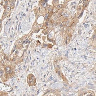 FXYD2 Antibody - BSA Free