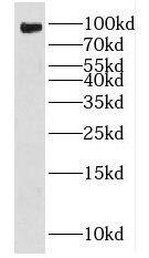 FXR2 Antibody - BSA Free