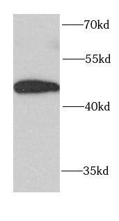 FUT6 Antibody - BSA Free