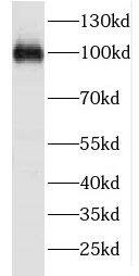 FSD2 Antibody - BSA Free