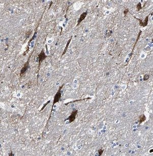 FSD1L Antibody - BSA Free