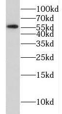 FSCN3 Antibody - BSA Free