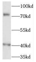 QBRICK/FREM1 Antibody - BSA Free