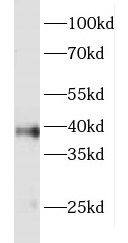 FOXR2 Antibody - BSA Free