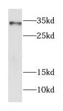 FOXE3 Antibody - BSA Free
