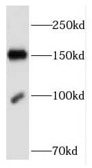 FNDC3B Antibody - BSA Free