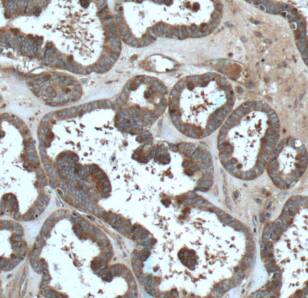 FMN2 Antibody - BSA Free