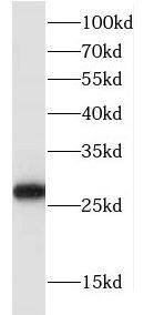 FKBP14 Antibody - BSA Free