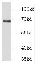 FIGNL1 Antibody - BSA Free