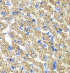 FIBP Antibody - BSA Free