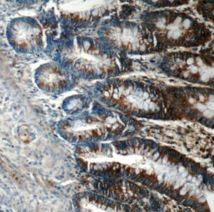 FIBCD1 Antibody - BSA Free