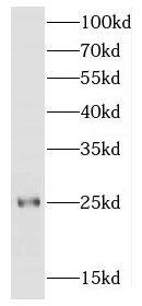 FGFR1OP2 Antibody - BSA Free