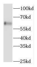 FGFBP3 Antibody - BSA Free