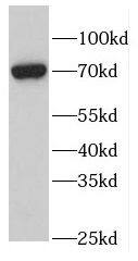 FEM1B Antibody - BSA Free