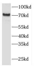 FEM1A Antibody - BSA Free