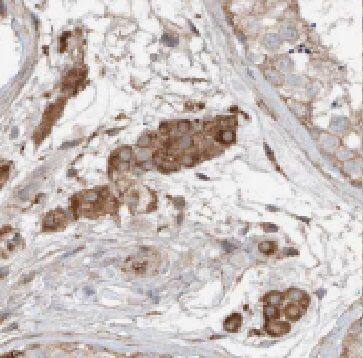 FDXACB1 Antibody - BSA Free