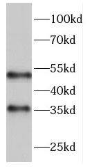 Ficolin-3 Antibody - BSA Free