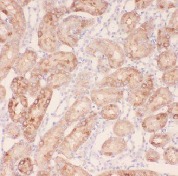 FBXW5 Antibody - BSA Free