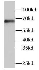 FBXW5 Antibody - BSA Free
