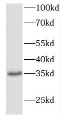 FBXO6 Antibody - BSA Free