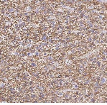 FBXO6 Antibody - BSA Free