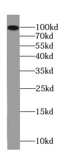 FBXO41 Antibody - BSA Free