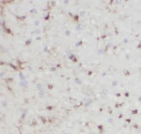FBXO41 Antibody - BSA Free