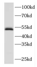 FBXO3 Antibody - BSA Free