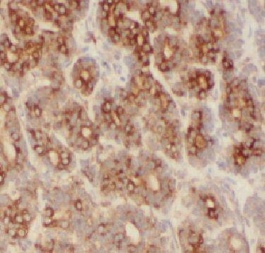 FBXO22 Antibody - BSA Free