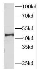 FBXO22 Antibody - BSA Free