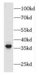 FBXO2 Antibody - BSA Free