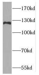 FBXO18 Antibody - BSA Free