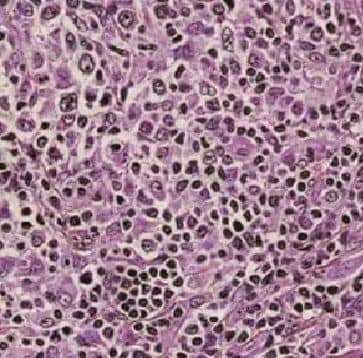 FBXL18 Antibody - BSA Free