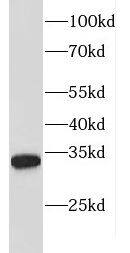 FBXL15 Antibody - BSA Free