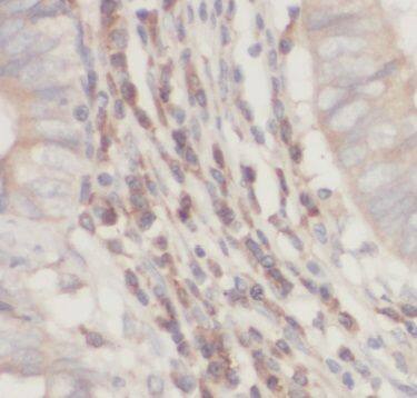 FBXL13 Antibody - BSA Free