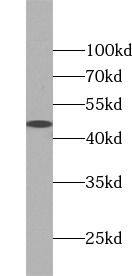 KRT40 Antibody - BSA Free