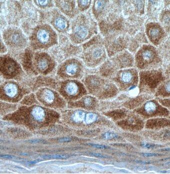 KRT34 Antibody - BSA Free