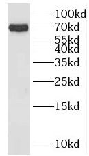 KLHL34 Antibody - BSA Free