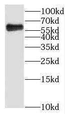 KLHL31 Antibody - BSA Free