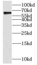 KLHL28 Antibody - BSA Free