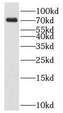 KLHL22 Antibody - BSA Free