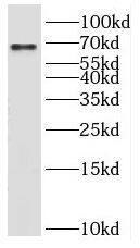 Kelch-Like Family Member 21 Antibody - BSA Free