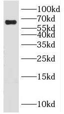 KLHL20 Antibody - BSA Free