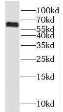 KLHL18 Antibody - BSA Free