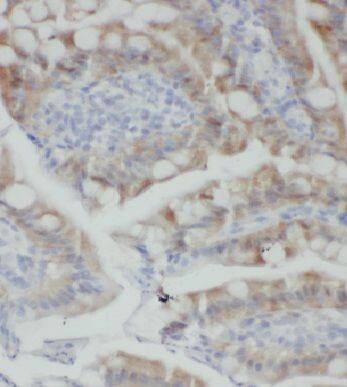 KLHL18 Antibody - BSA Free