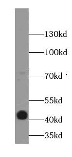 KLHL14 Antibody - BSA Free