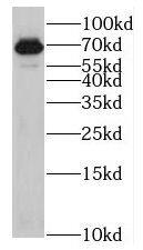 KLHL13 Antibody - BSA Free