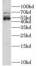 KLHL12/C3IP1 Antibody - BSA Free